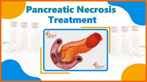 Pancreatic Necrosis | Pancreatic Necrosis Treatment | Pancreatic ...