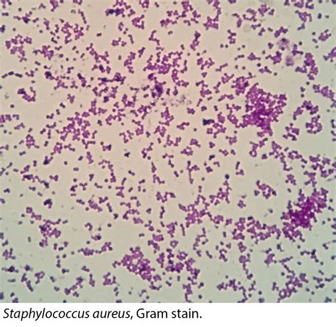 Gram-Positives (Staphylococcus, Streptococcus, Clostridium, etc ...