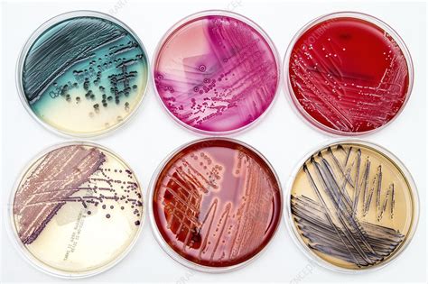 Bacterial growth on culture media - Stock Image - C029/1373 - Science ...