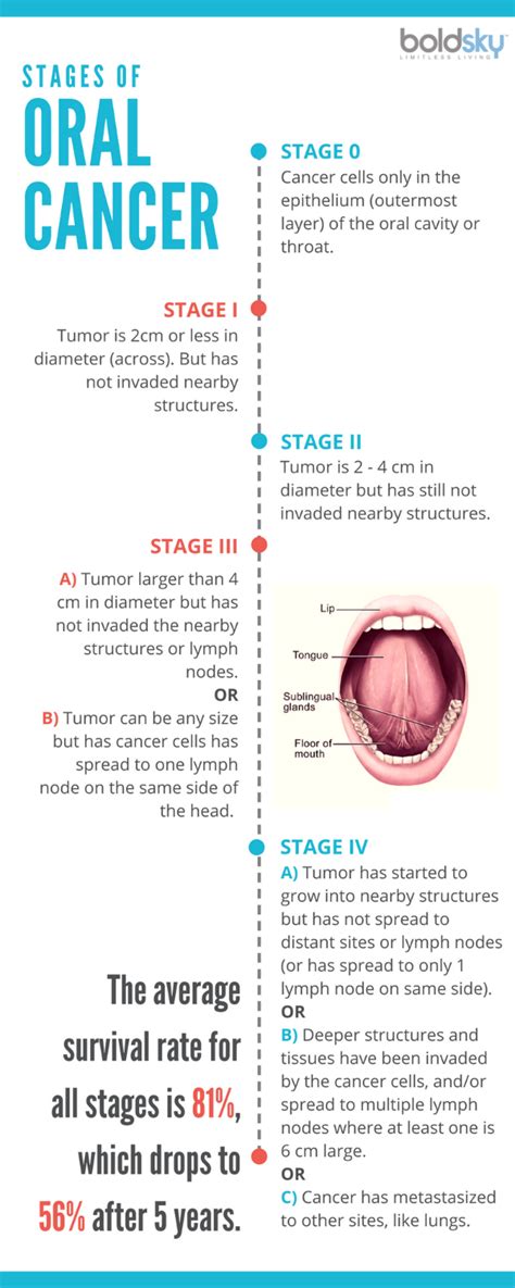 What is Oral Cancer? Symptoms, Stages, and Cure - Boldsky.com