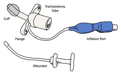 Cuffed Tracheostomy Tube