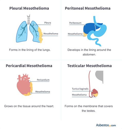 Mesothelioma Overview: Symptoms, Treatment & Prognosis