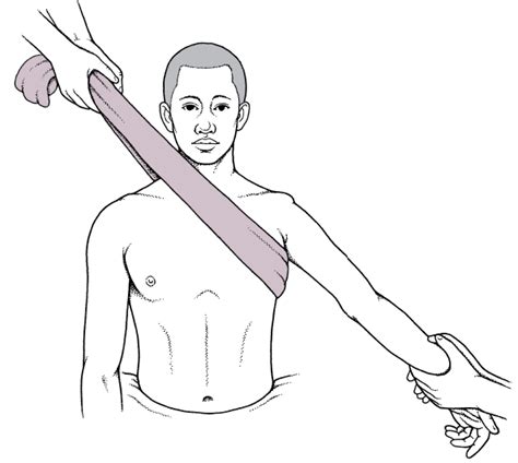 Shoulder Dislocations - Injuries; Poisoning - Merck Manuals ...