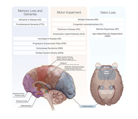 Advancing cell therapy for neurodegenerative diseases – Gain Company