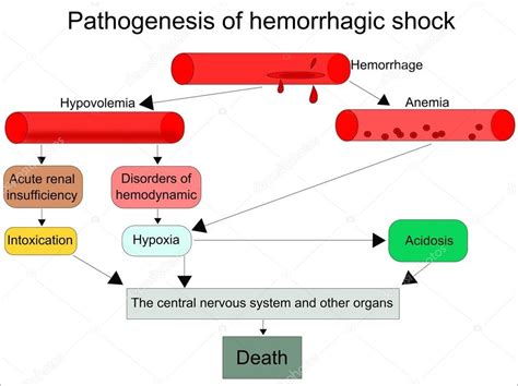 Hemorrhagic Shock Flow Chart