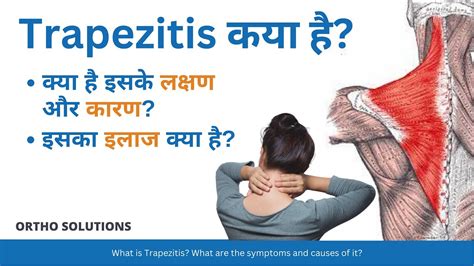 Trapezitis kya hai? kya hai isake lakshan aur kaaran? What is ...