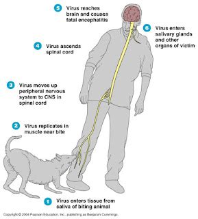 symptoms of rabies in human