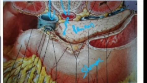 Retroperitoneum : anatomy course- retroperitoneal peritoneum - YouTube