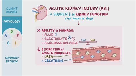 Acute kidney injury (AKI): Nursing process (ADPIE) - Osmosis Video Library