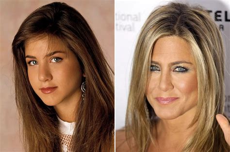 Celebrity Nose Jobs - Before & After - Irish Mirror Online