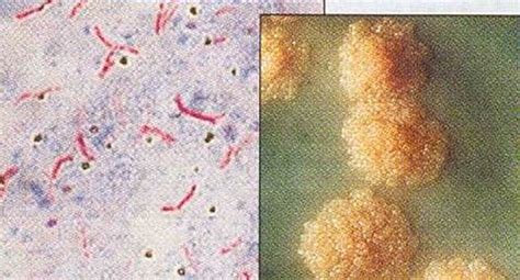 Mycobacterium tuberculosis Morphology, Characteristics, Acid fast Stain ...