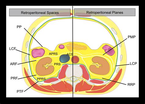 Drawing of the anatomy of the retroperitoneal spaces at the level of ...