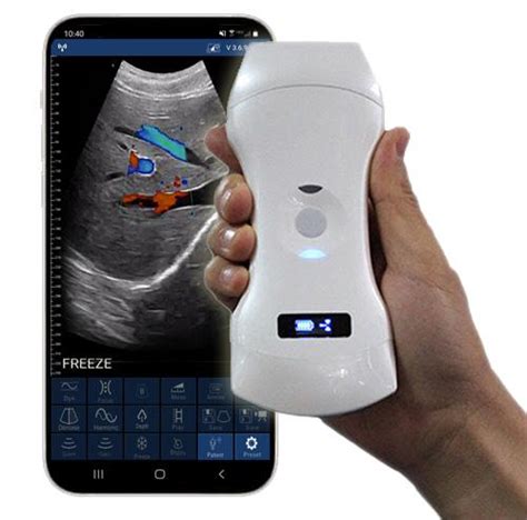 Ultrasound – Edge Life Technologies - The Leading Innovators In ...