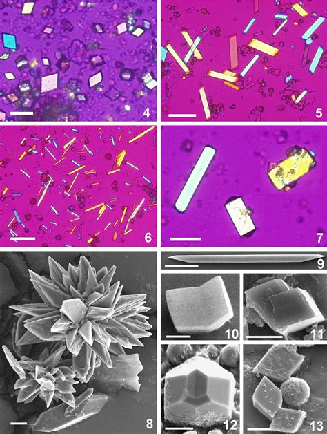 Direct Nucleation Of Calcium Oxalate Dihydrate Crystals, 46% OFF