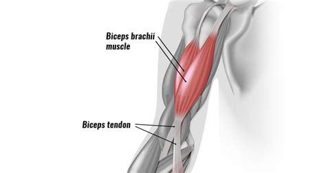 Biceps Tendonitis at the Elbow - Symptoms, Causes & Treatment.