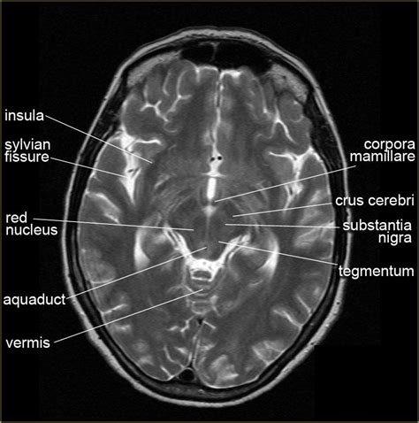 Anatomy | Brain anatomy, Radiology imaging, Radiology