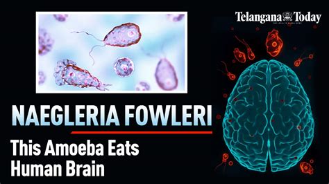 NAEGLERIA FOWLERI (The Brain-Eating Amoeba) – Explained | Symptoms ...