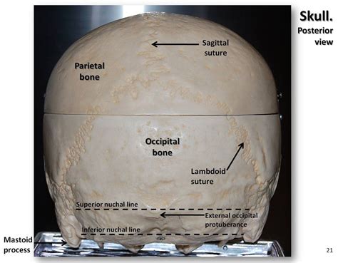 Back Of Skull Anatomy : Lecture 5--Axial Skeletal System at University ...