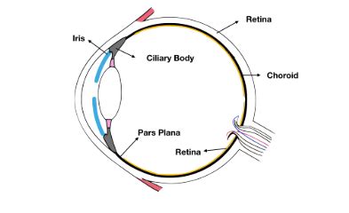 How to diagnose and manage uveitis - EyeGuru