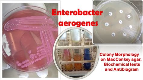 Enterobacter aerogenes Colony Morphology on MacConkey agar, Biochemical ...