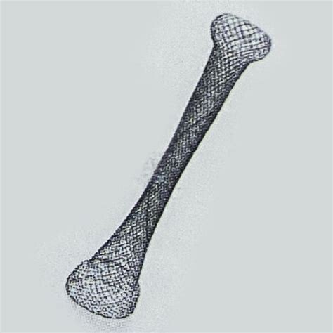 Bronchial stent - ST4-106OF-A - Sinolinks Medical Innovation