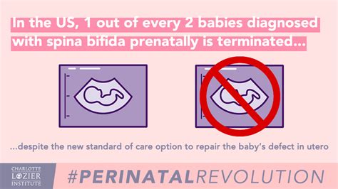 Advancements in Fetal Surgery for Treating Spina Bifida - Lozier Institute