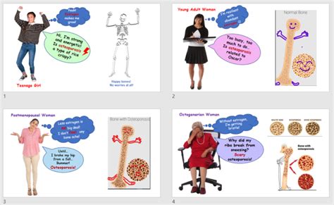 Estrogen and Postmenopausal Osteoporosis – Human STEAM