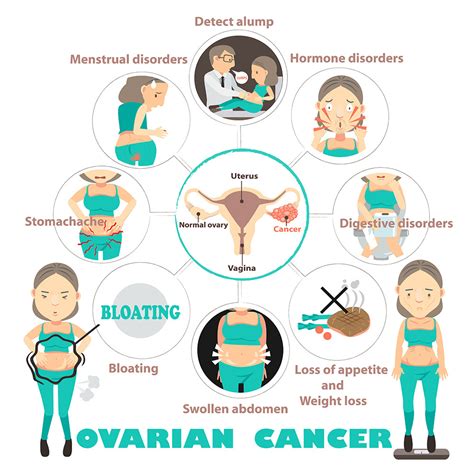 How you get ovarian cancer