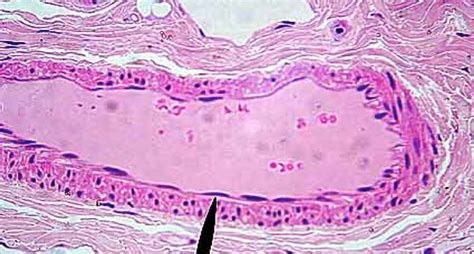 simple squamous epithelium - Google Search | Histology slides, Squamous ...