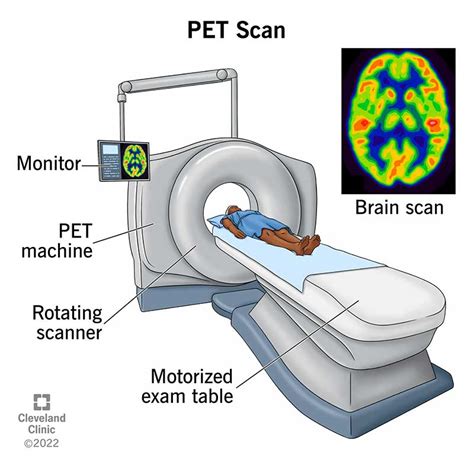 PET Scan: What It Is, Types, Purpose, Procedure & Results