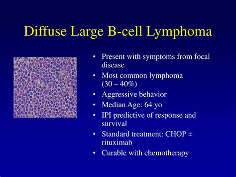 Diffuse Large B Cell Lymphoma Symptoms