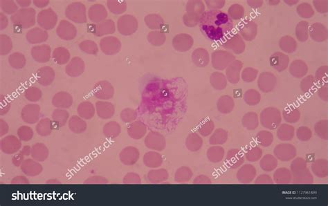 Basket Cell On Red Blood Cells Stock Photo 1127961899 | Shutterstock