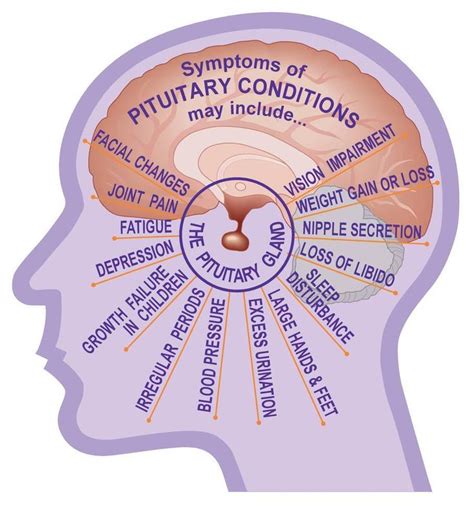 48 best Acromegaly, Pituitary Tumor, Prolactinoma, POTS, Brain Cancer ...