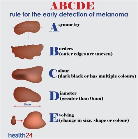 Can you recognise the signs of skin cancer? | Health24