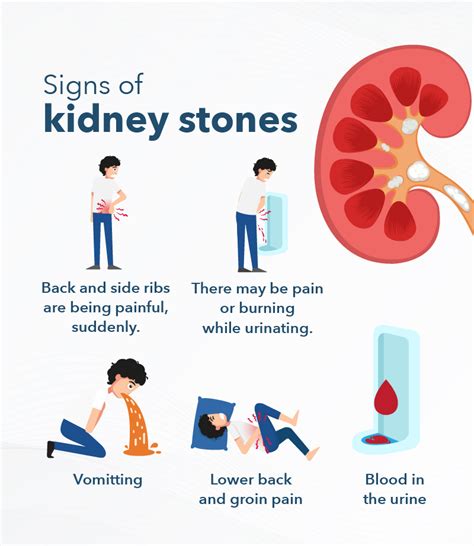 Left Kidney Pain Symptoms Causes And Treatments