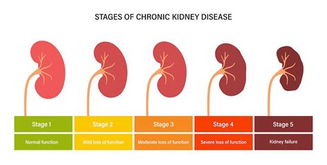 Understanding The 5 Stages of Kidney Disease - Durham Nephrology ...