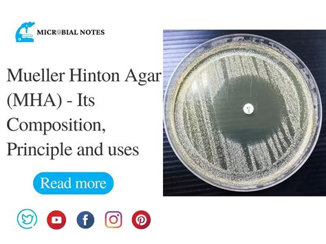 Mueller Hinton Agar -Its Composition, Uses, and Preparation