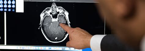 Brain Tumor Symptoms and Diagnosis | Brain Institute | OHSU