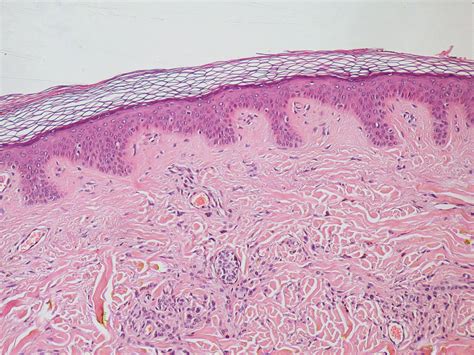 Areolar Connective Tissue Structure & Function - Education Is Around