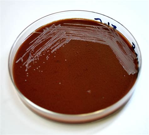 Free picture: chocolate, agar, inoculated, gram, negative, francisella ...