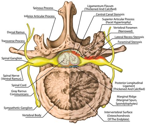 Ligamentum Flavum