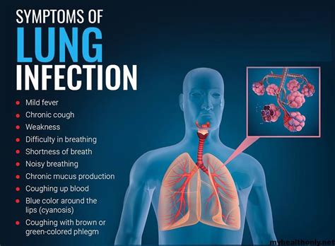 5 Signs and Symptoms of lung infection - My Health Only