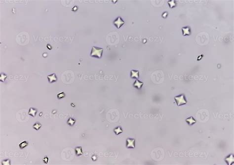 Vestibular System Calcium Crystals