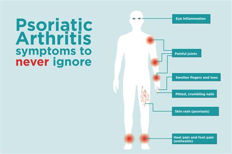 Psoriatic Arthritis Signs and Symptoms