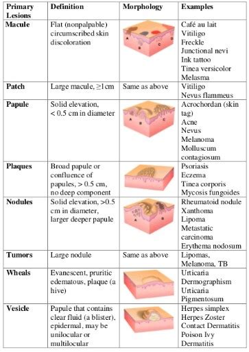 Macule Vs Papule