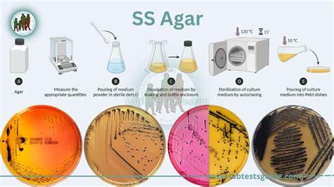 Salmonella-Shigella agar Purpose Procedure, Result and more