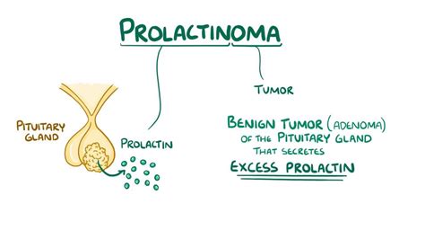 Prolactinoma: Video, Anatomy, Definition & Function | Osmosis