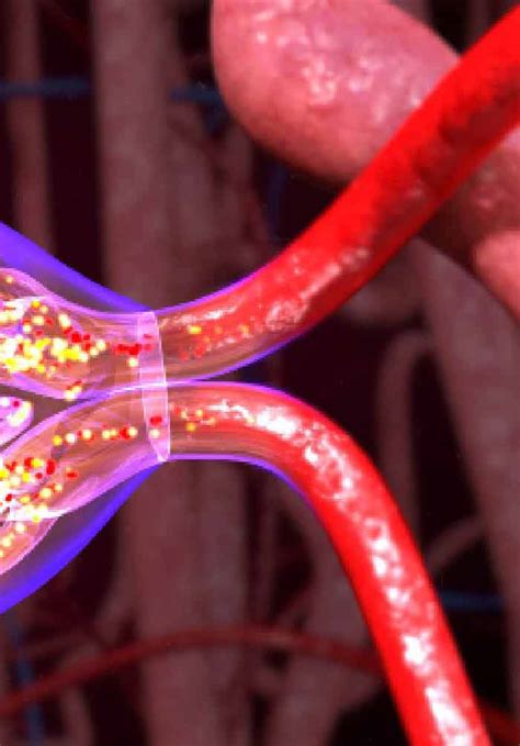 Principles of Haemodiafiltration: Rationale for Improved Patients ...