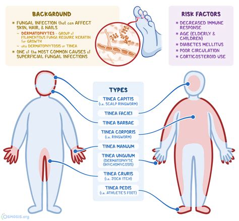 indossare biologico pupazzo di neve fungal infection symptoms in body ...