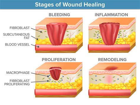 Wound Healing & OCT - Wasatch PhotonicsWasatch Photonics